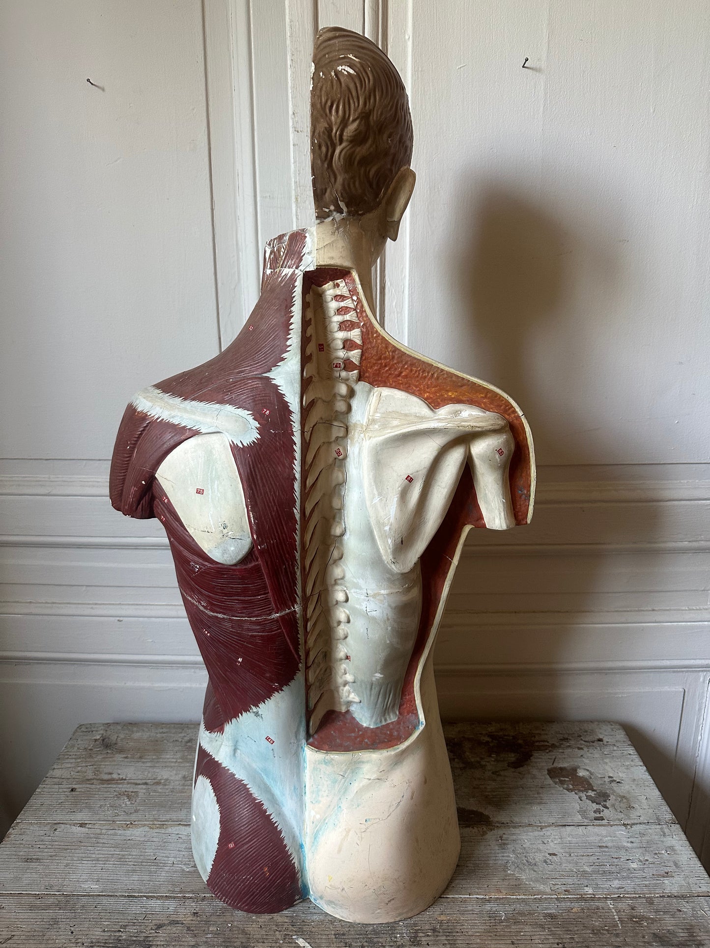 Écorché en plâtre