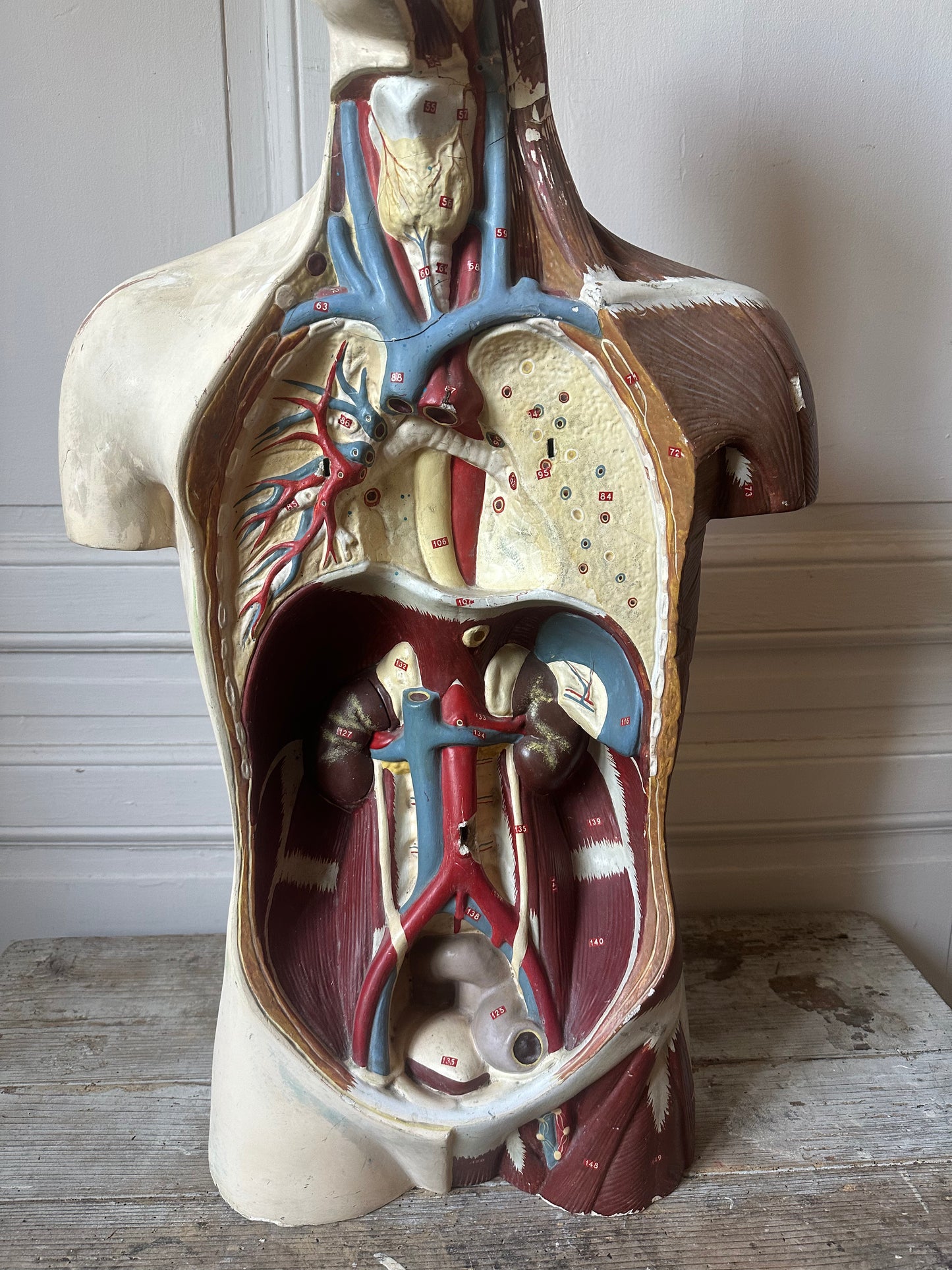Écorché en plâtre
