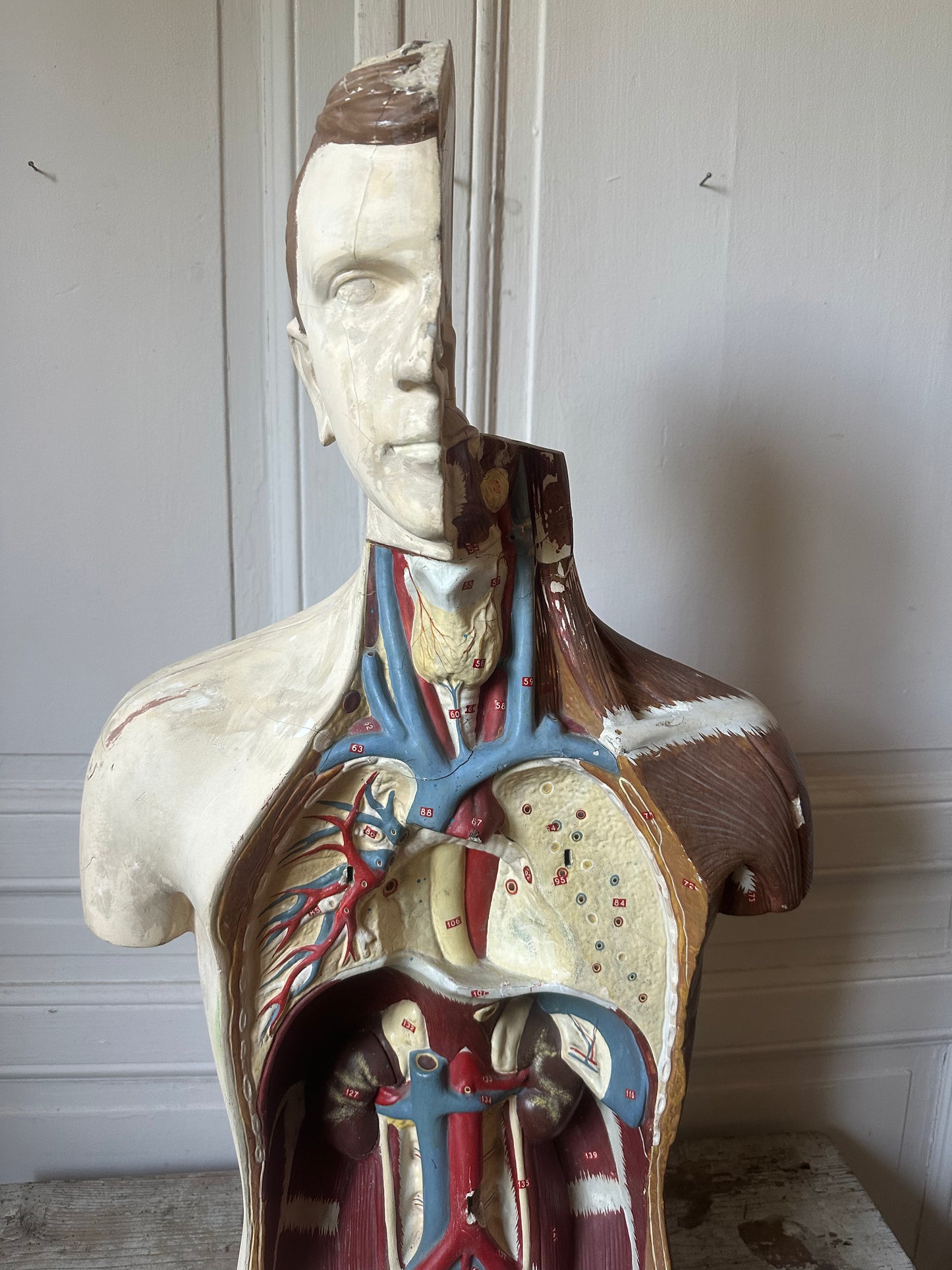 Écorché en plâtre