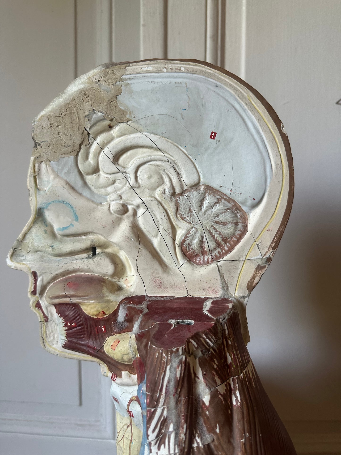 Écorché en plâtre