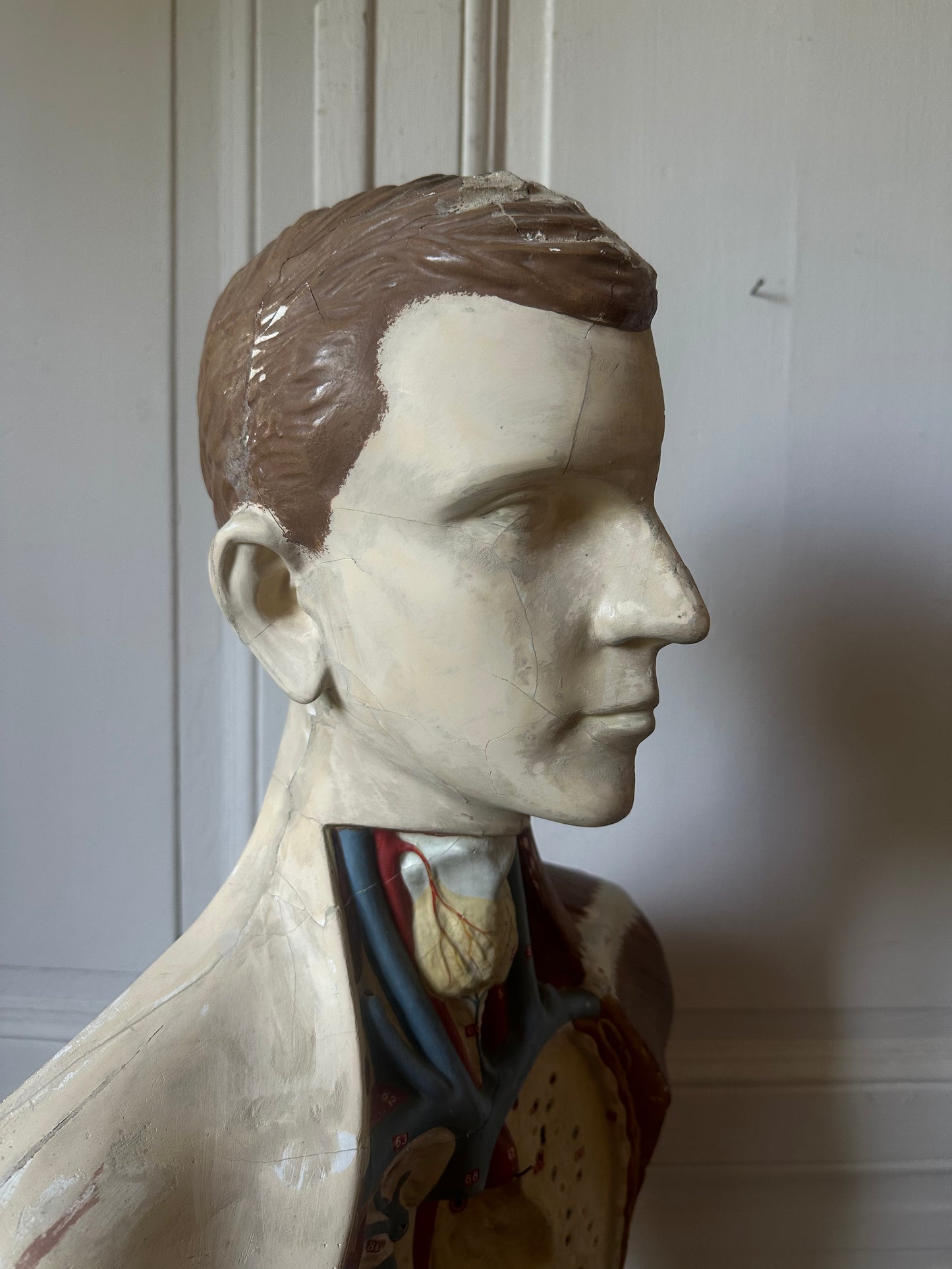 Écorché en plâtre